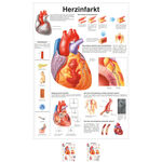 Poster "Herzinfarkt", LxB 70x50 cm