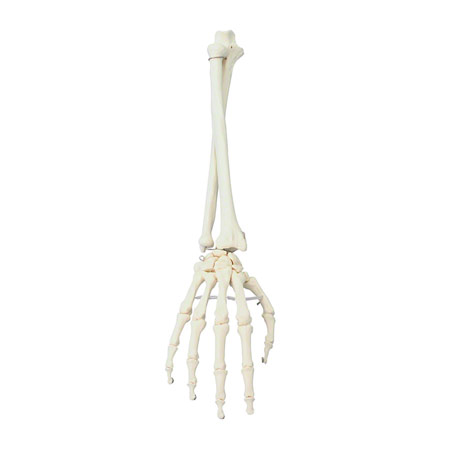 Anatomische Modelle - Hand mit Stumpf, beweglich