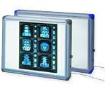 Rntgenbildbetrachter