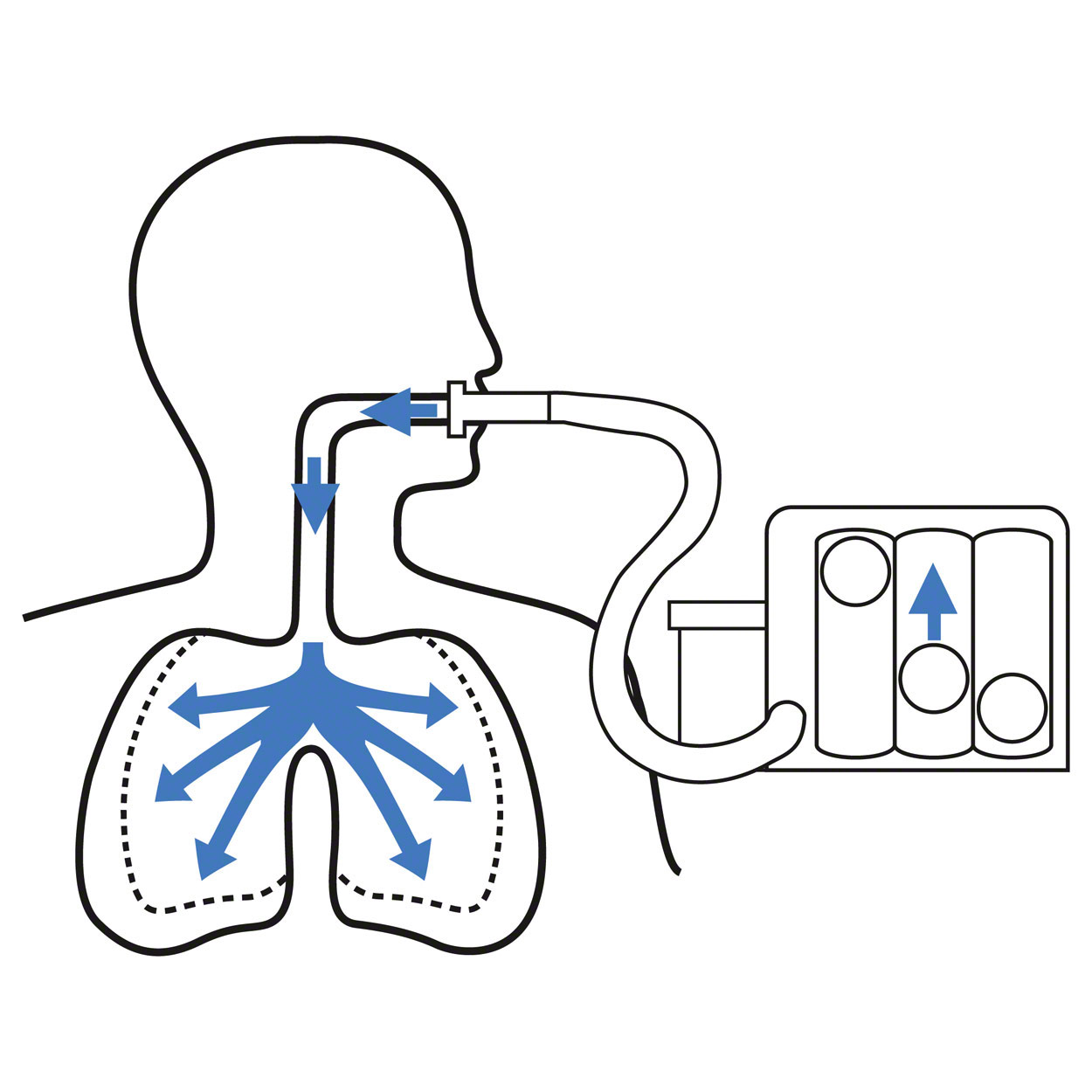 TRI-BALL Allenatore Respiratorio Con 3 Palline - Migliora Capacit&agrave; Polmonare, 600-1200 Cc/sec