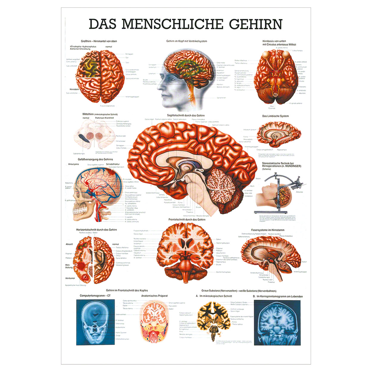 Das gehirn Lehrtafel Anatomie 100x70 cm medizinische Lehrmittel<br> Nicht Laminiert