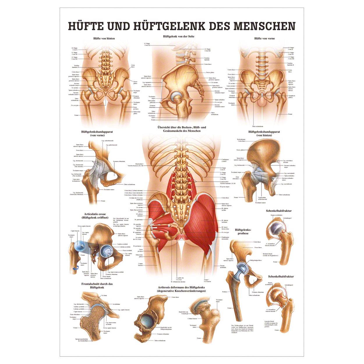 Hüfte und Hüftgelenk Lehrtafel Anatomie 100x70 cm medizinische Lehrmittel<br> Nicht Laminiert