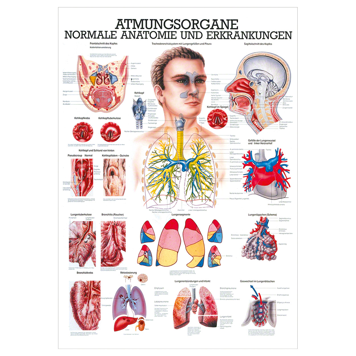 Die Atmungsorgane Lehrtafel Anatomie 100x70 cm medizinische Lehrmittel<br> Nicht Laminiert