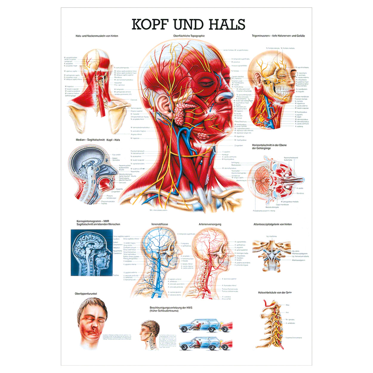 Kopf und Hals Lehrtafel Anatomie 100x70 cm medizinische Lehrmittel<br> Nicht Laminiert