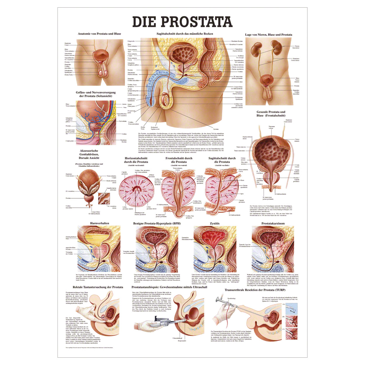 Die Prostata Lehrtafel Anatomie 100x70 cm medizinische Lehrmittel<br> Nicht Laminiert