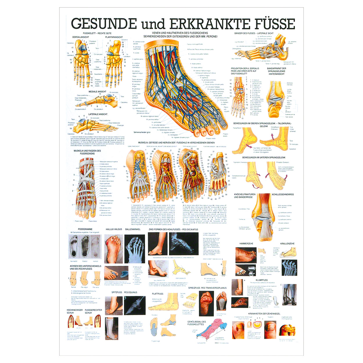 Der Fuß Lehrtafel Anatomie 100x70 cm medizinische Lehrmittel<br> Nicht Laminiert