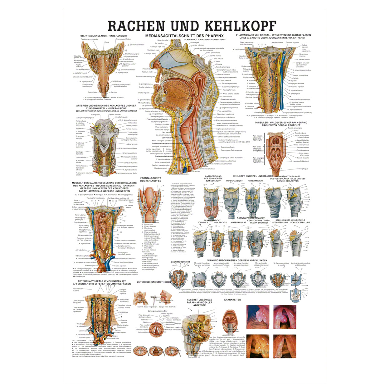 Rachen und Kehlkopf Lehrtafel Anatomie 100x70 cm medizinische Lehrmittel<br> Nicht Laminiert