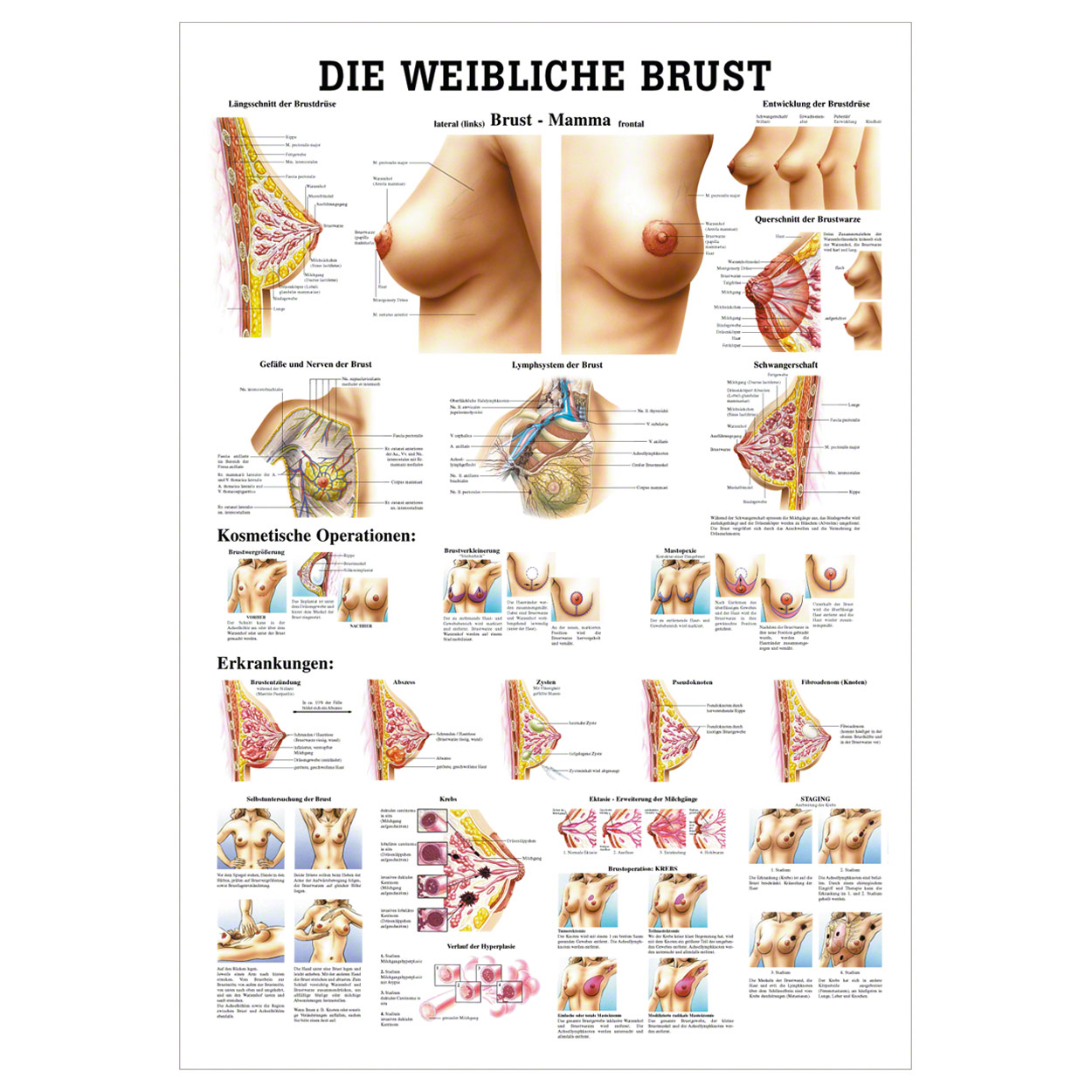 Weibliche Brust Lehrtafel Anatomie 100x70 cm medizinische Lehrmittel<br> Nicht Laminiert
