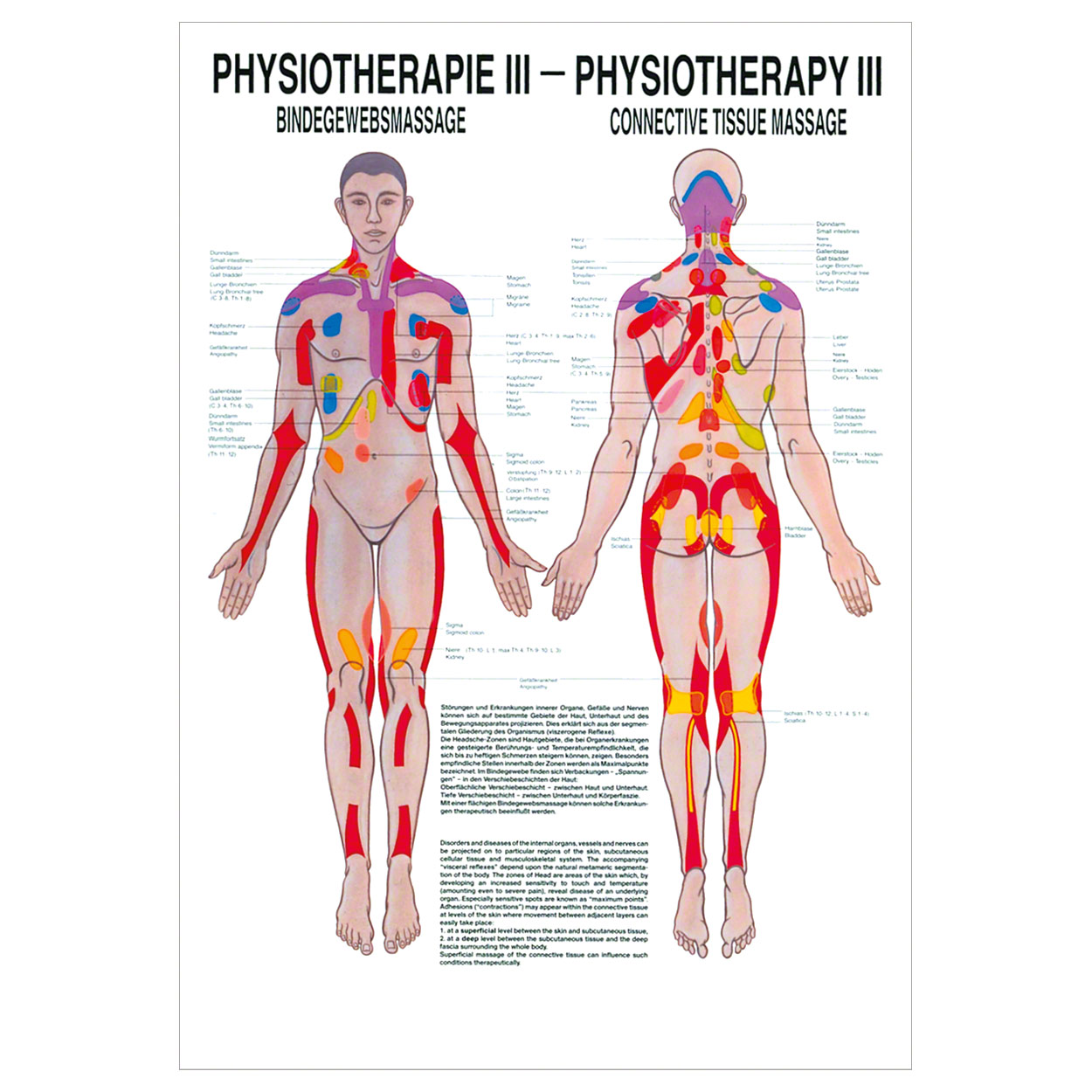 Bindegewebsmassage Poster Anatomie 70x50 cm medizinische Lehrmittel<br> Nicht Laminiert