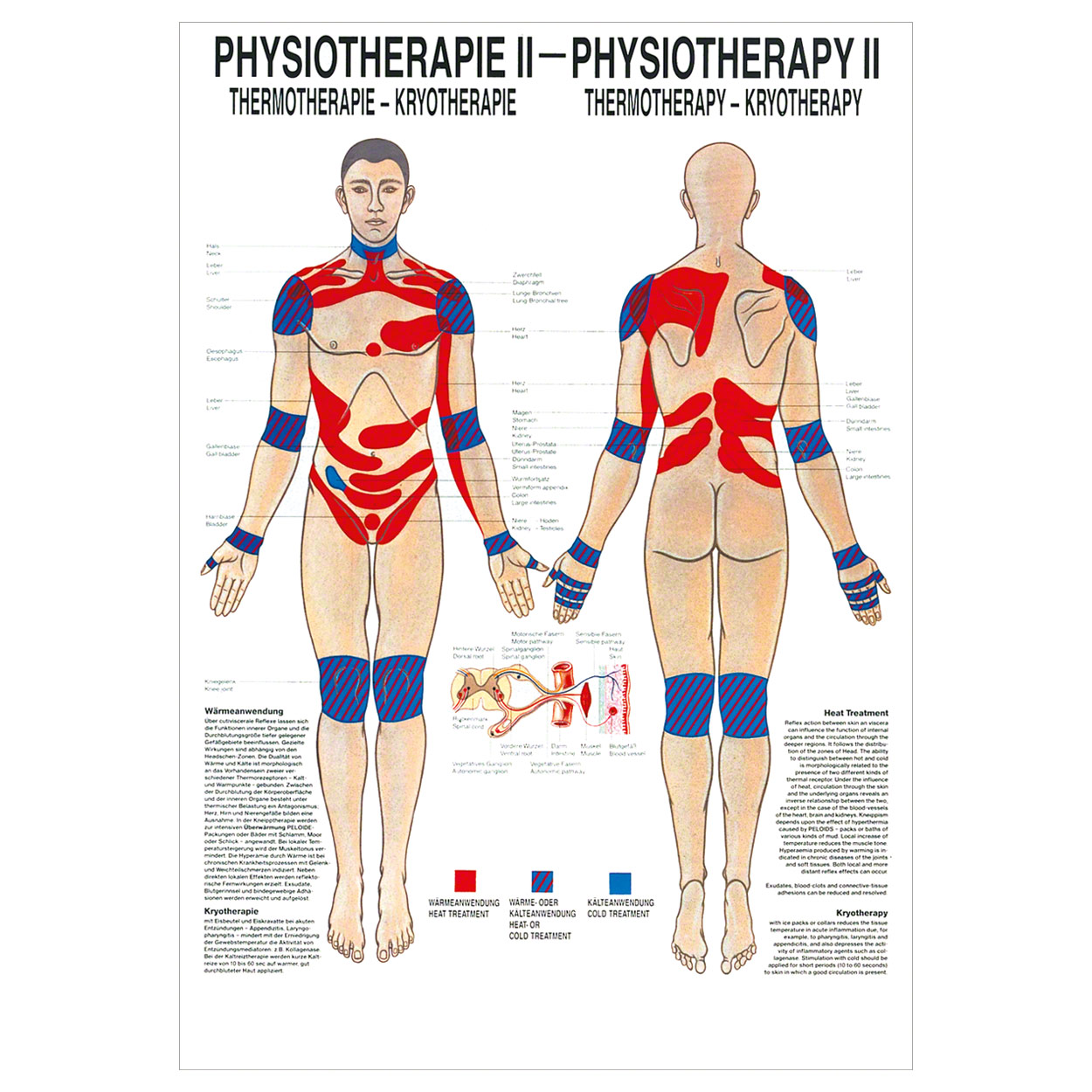 Thermotherapie Mini-Poster Anatomie 34x24 cm medizinische Lehrmittel<br> Nicht Laminiert