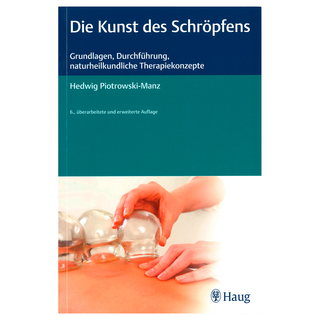 Buch Die Kunst des Schröpfens - Schröpfen<br> effektiv und wirksam