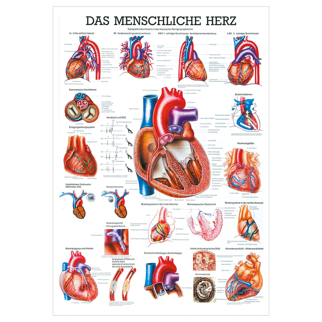Sport-Tec Anatomie Poster Atmungsorgane - Medizinisches Lehrmittel 34x24cm