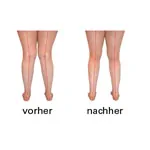 OrtoMalli Einlegesohlen