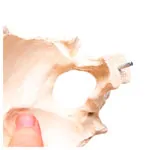 Abbildung zeigt Anatomisches Modell Stecksch�del, 18-tlg., wei�