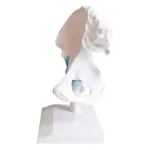 Abbildung zeigt Hftgelenk, L x B x H 17 x 17 x 23 cm