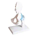 Abbildung zeigt Hftgelenk, L x B x H 17 x 17 x 23 cm