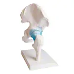 Abbildung zeigt Hftgelenk, L x B x H 17 x 17 x 23 cm