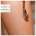 Sensibilittsrad nach Wartenberg, 17 cm