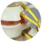 Anatomie-Set: Schdel 4-tlg. und Wirbelsule mit Bandscheibenvorfall
