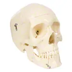Anatomie-Set: Schdel 4-tlg. und Wirbelsule mit Bandscheibenvorfall