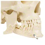 Anatomie-Set: Schdel 4-tlg. und Wirbelsule mit Bandscheibenvorfall
