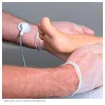 Abbildung zeigt DEEP OSCILLATION Einmal-Klebeelektroden, � 5,5 cm, 60 St�ck