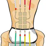 Compex Elektroden Wire, 5x5 cm, 4 Stck