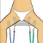 Compex Elektroden Wire, 5x10 cm, 2 Stck