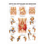 Hüfte und Hüftgelenk Lehrtafel Anatomie 100x70 cm medizinische Lehrmittel<br> Nicht Laminiert