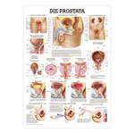 Die Prostata Lehrtafel Anatomie 100x70 cm medizinische Lehrmittel<br> Nicht Laminiert
