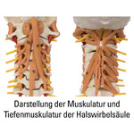 Halswirbelsule mit Halsmuskulatur, LxHxB 25x10x18 cm