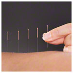 Akupunkturnadeln mit Kupferwendelgriff, 0,30x30 mm, 100 Stck