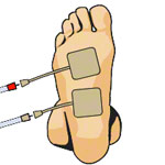 Compex Elektroden Wire, 5x5 cm, 4 Stck