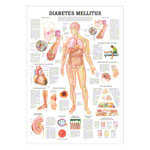 Lehrtafel Diabetes Mellitus, LxB 100x70 cm