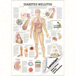 Lehrtafel Diabetes Mellitus, LxB 100x70 cm