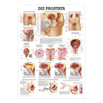 Lehrtafel Die Prostata LxB 100x70 cm