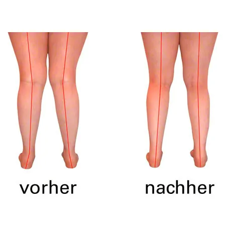 OrtoMalli Einlegesohlen