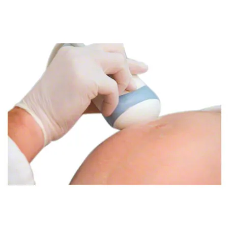 Ultraschallgel Echoson, 250 ml