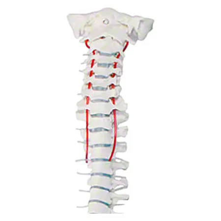 Wirbels�ule mit Bandscheibenvorfall inkl. Stativ, 80 cm
