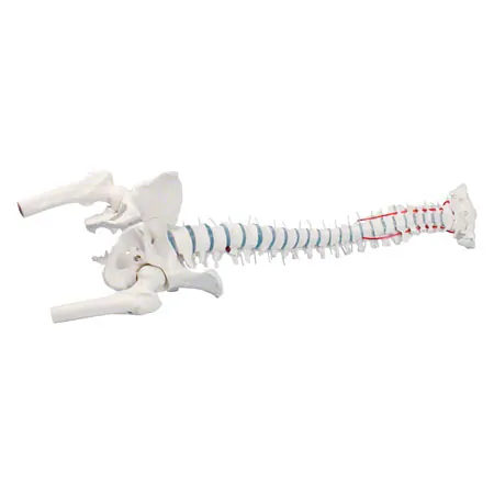 Wirbels�ule mit Bandscheibenvorfall inkl. Stativ, 80 cm