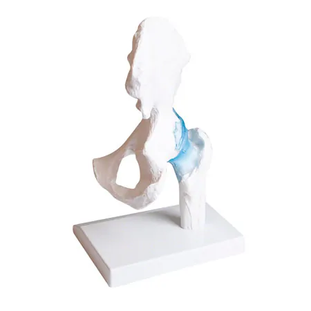 Hftgelenk, L x B x H 17 x 17 x 23 cm