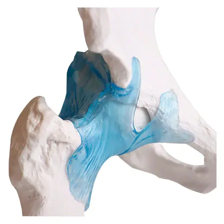 H�ftgelenk, LxBxH 22x30x20 cm