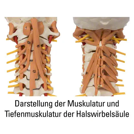 Halswirbelsule mit Halsmuskulatur, LxHxB 25x10x18 cm