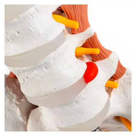 M�nnliches Becken mit LWS und Lendenmuskeln