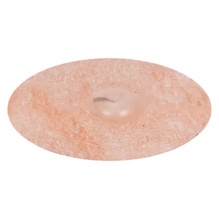 Akupunktur Dauernadeln Seirin New Pyonex, gelb, 0,15x0,60 mm, 100 Stck