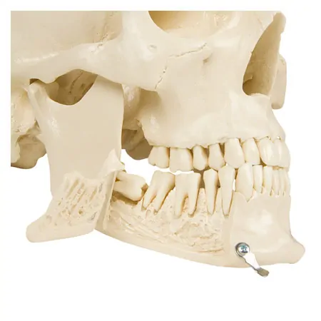 Anatomie-Set: Schdel 4-tlg. und Wirbelsule mit Bandscheibenvorfall