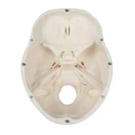 Anatomie-Set, Schdel + Wirbelsule mit Bandscheibenvorfall inkl. Stativ, 5-tlg.