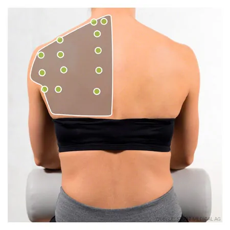 STORZ MEDICAL Stosswellentherapiegert MASTERPULS ONE