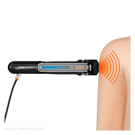 STORZ MEDICAL Handstck SPARROW fr MASTERPULS ONE