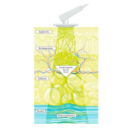 PHYSIOMED DEEP OSCILLATION Personal Home, inkl. Zubeh�r